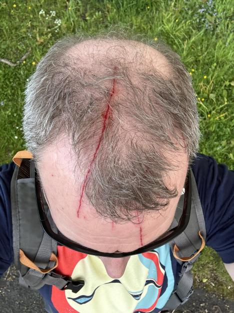 Village in Turmoil: Locals and Cyclists Under Attack from Aggressive Buzzard Divebombs!