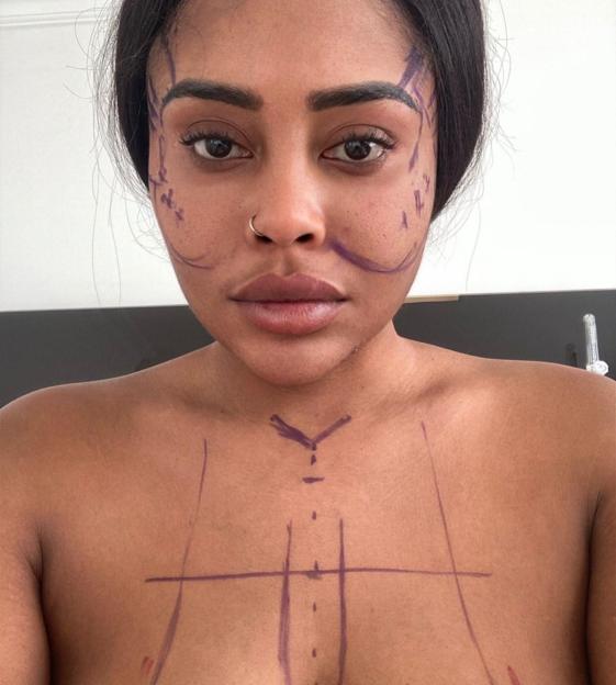 A woman with surgical markings on her face and chest.
