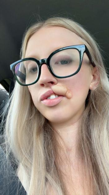 A dog Id known for years ripped my face apart in seconds  I just want to look normal again