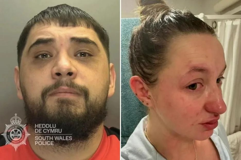 My ex knocked my tooth out & whipped me with a dog leash – now he’s out of jail in months & I’m fearing for my life