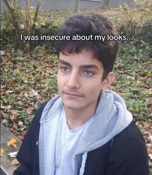 A young man with light blue eyes and dark hair, wearing a grey hoodie and black jacket, with text overlay reading "I was insecure about my looks..."
