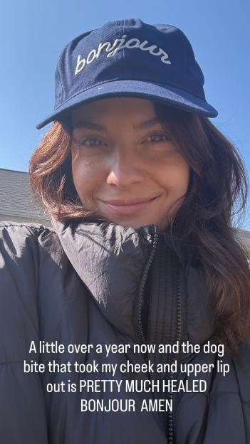 'Hit Drama Series Star Opens Up About Shocking Injuries from Dog Attack'