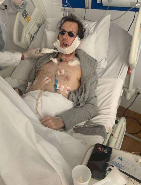 Andrè Gayoso in a hospital bed with his jaw reconstructed, surrounded by medical equipment.