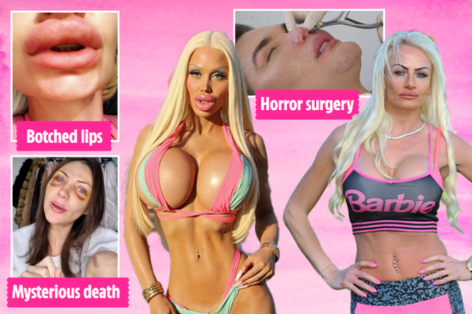 Unveiling the Dark Side of Human Barbies: Shocking Deaths, Flesh-Eating Surgeries, and Baby Oil Lip Fillers