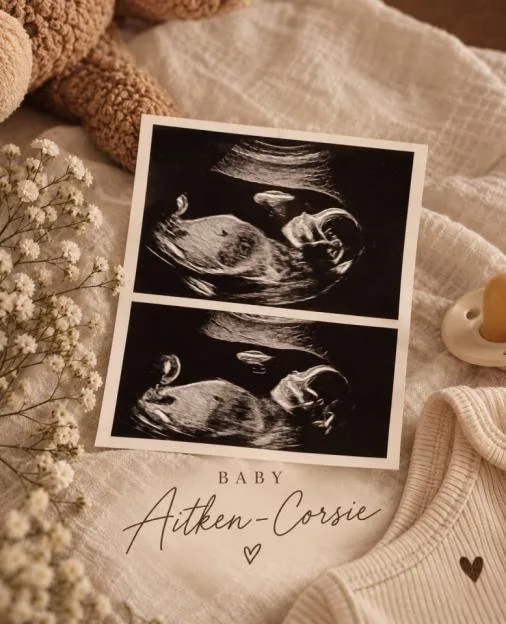 Sky Sports presenter announces she’s expecting first child with fiancee and reveals due date
