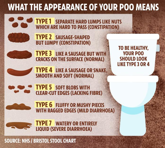 a poster explaining what the appearance of your poo means