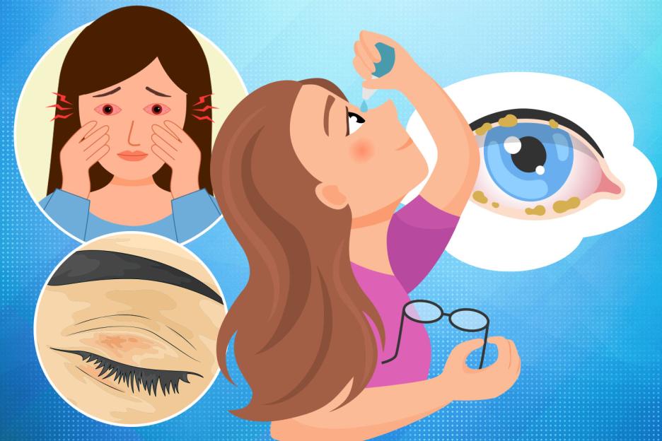 'Is Your Itchy Eyes Something More? Discover When to Seek Urgent Help as 'Pollen Bombs' Hide Serious Infections'