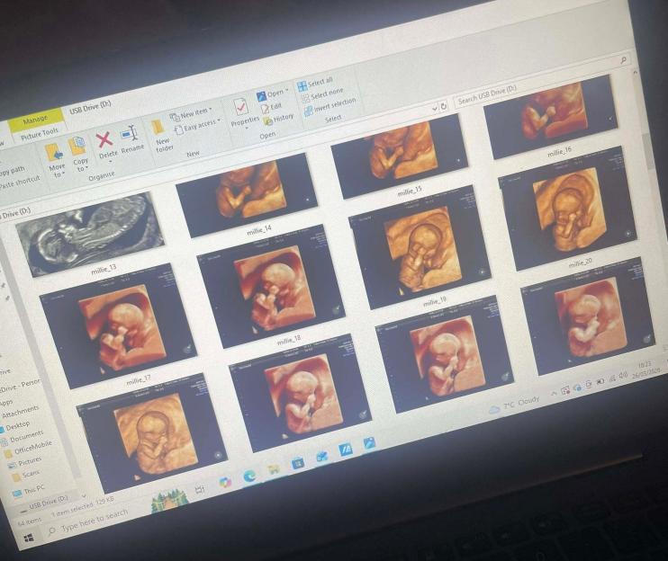A computer screen displaying an open folder with multiple ultrasound images, one with the file name "millie_13" and another "millie_14".