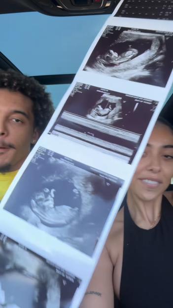 Mya Mills and Jeremy Sochan holding up ultrasound images.