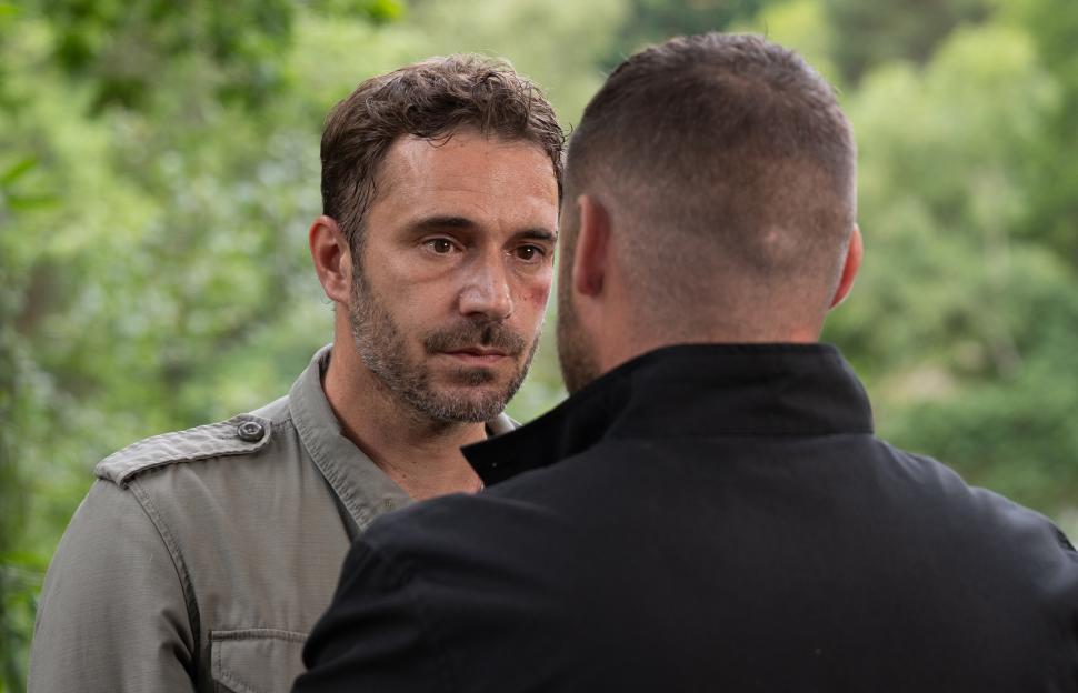 A man with a bruised face looks at another man from over his shoulder.