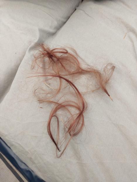 Kelly Prosser’s ripped out hair extensions.