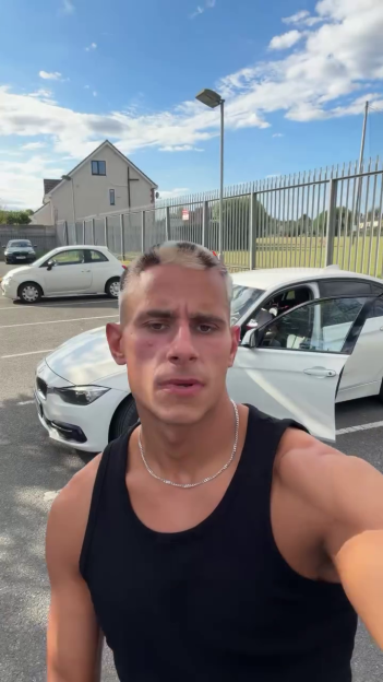 Fitzy from Love Island shows off his new animal-print hairstyle.