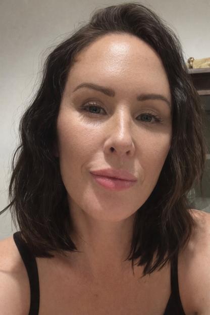 Jojo McGinniss after her facelift.