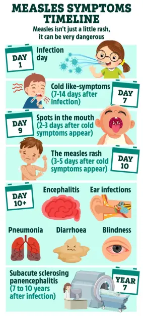 a poster showing the measles symptoms timeline