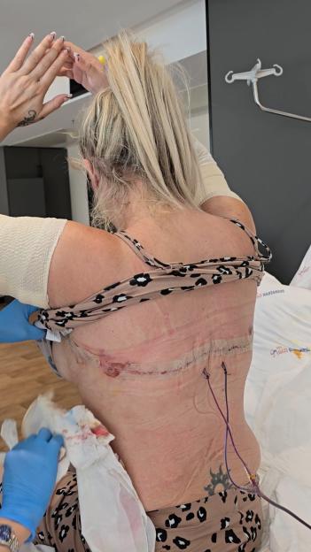 Im like Frankensteins bride after having FULL BODY makeover  even my eyelids and vagina have been transformed