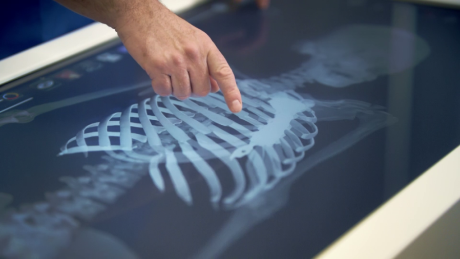 A person's hand pointing at a rib cage displayed on a digital screen, showing a skeletal x-ray.