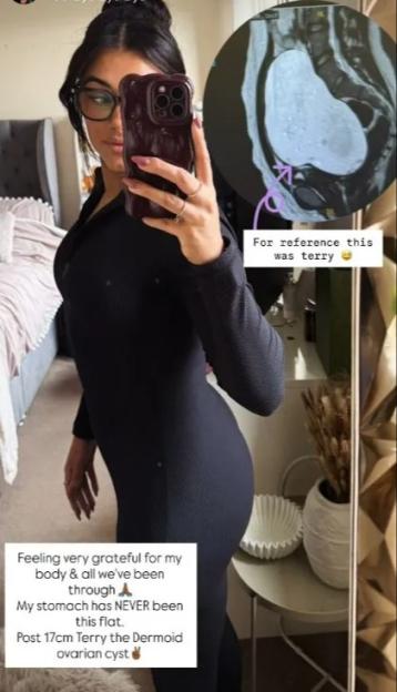 MAFS Bride Reveals Shocking Cyst in Stunning Post-Op Scan Photos!