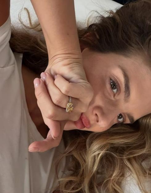 A woman with light brown hair and a tan wearing a ring with an oval yellow diamond on her left ring finger.