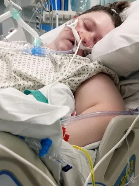 Woman's bowel explodes after 50 pieces of faecal matter became lodged in stomach