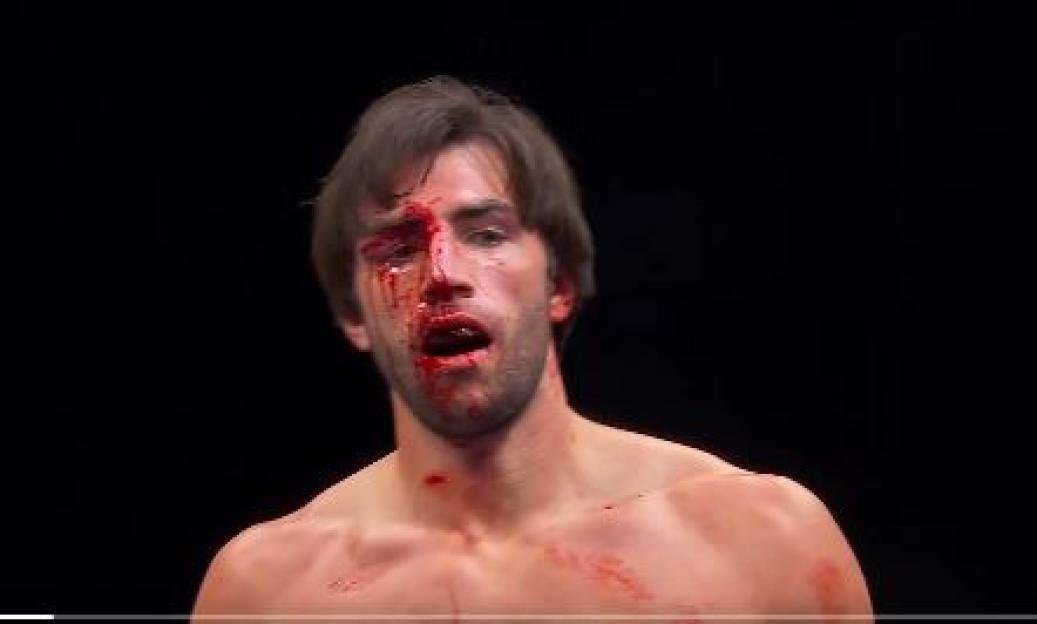 'Love Island's Jack Fincham Left Bloodied After Bareknuckle Brawl with Aaron Chalmers, Fight Stopped by Doctor'