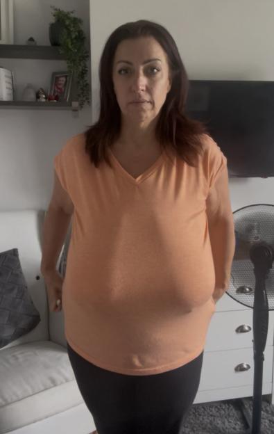 "I Struggled with My 38JJ Breasts, Battling Pain and Debt After NHS Denied My Surgery"
