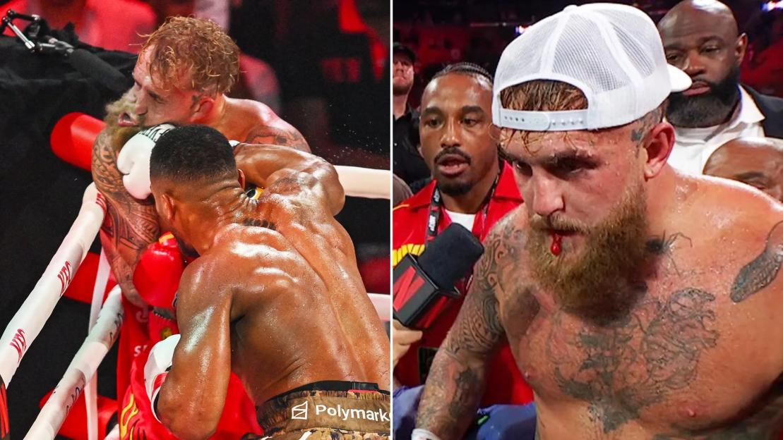Jake Paul Rushed to Hospital Following Loss to Anthony Joshua