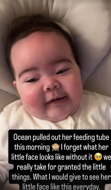 A baby with dark hair and rosy cheeks smiles while lying down, with text lamenting a feeding tube being pulled out.