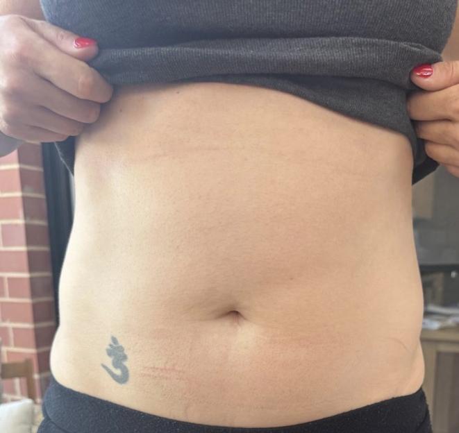 Woman lifting her shirt to reveal an om symbol tattoo on her lower abdomen.