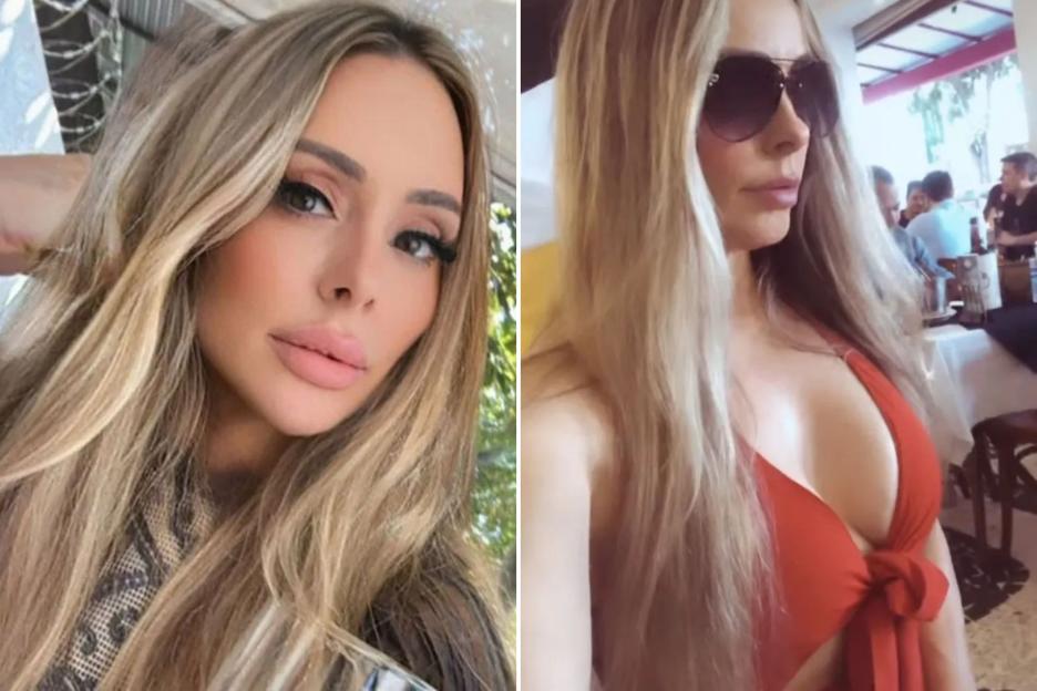 51-Year-Old Woman Passes Away Just Hours After Complicated Six-in-One Cosmetic Surgery Left Her Swollen and Breathing Difficulties