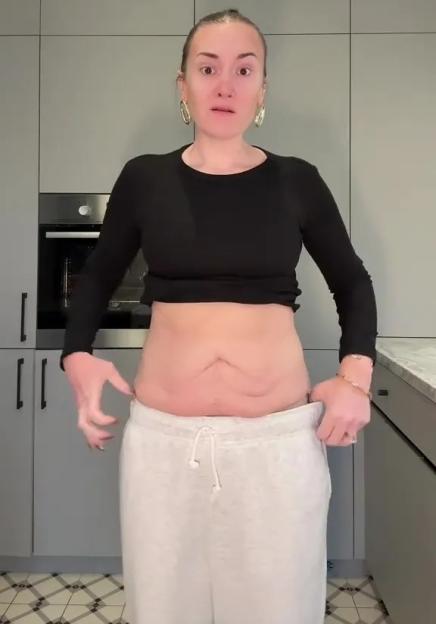 Woman showing loose skin on her abdomen after weight loss, with text "Not everyone will show you this side of their journey".