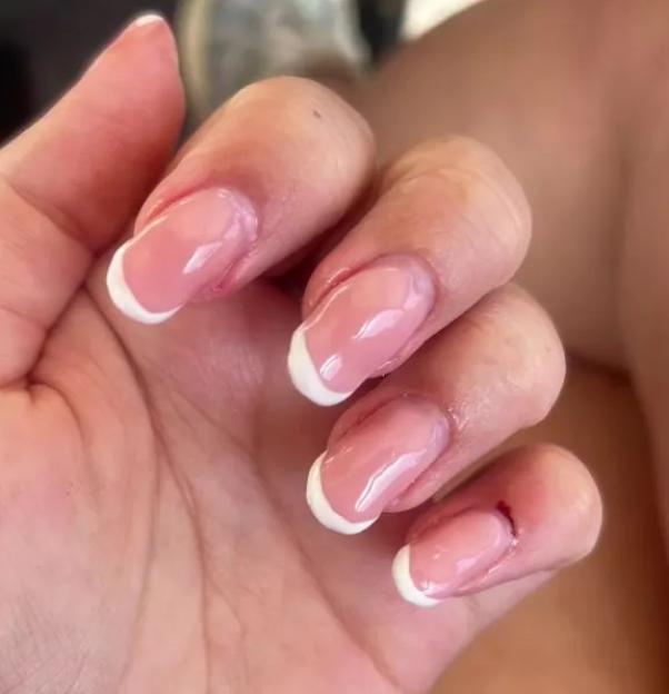 Hand with poorly done french tip nails.