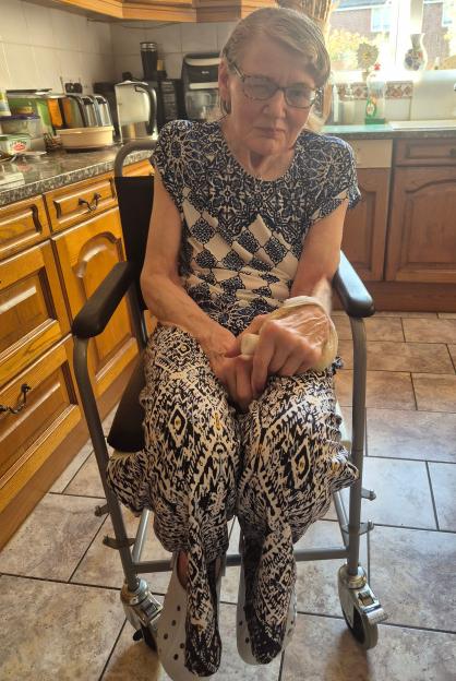 A woman with glasses sitting in a wheelchair, holding a white grip in her hands, and wearing patterned clothes and grey clogs.