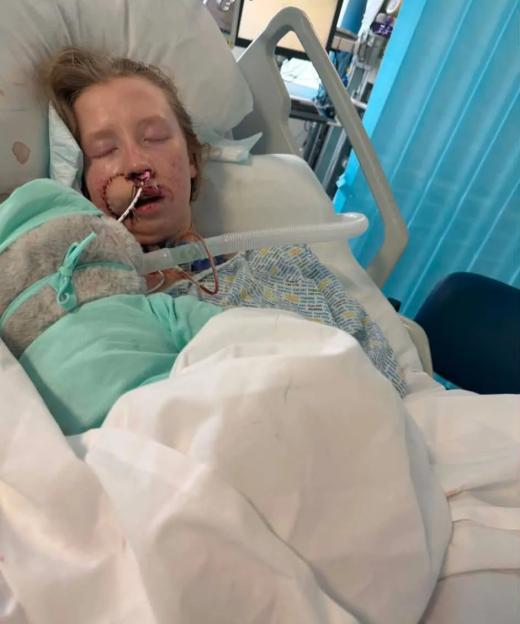 A dog Id known for years ripped my face apart in seconds  I just want to look normal again