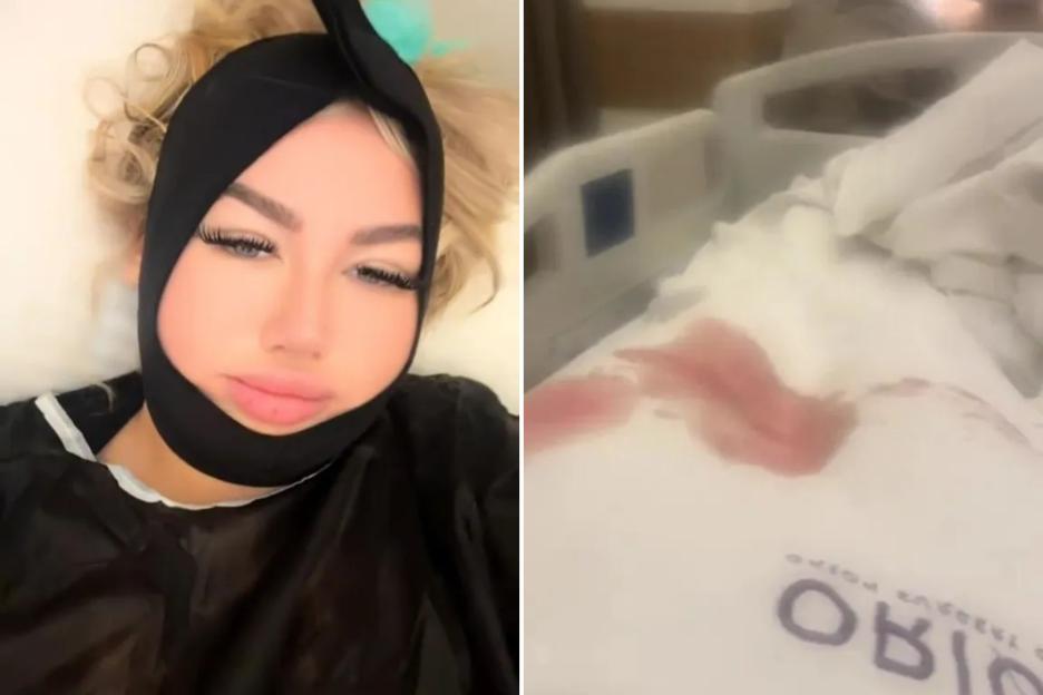 I had 6 Turkey surgeries in 1 day – my hospital room looked like the Texas Chainsaw Massacre & my butt was in bits