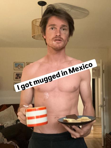 MAFS UK Star Suffers Collapsed Lung and Severe Cuts After Shocking Mugging in Mexico