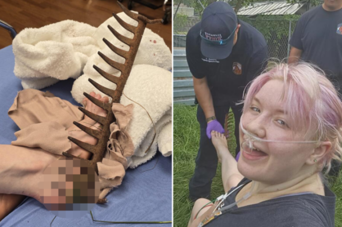 'Impaled by a Rusty Rake While Carrying My Toddler: A Harrowing Experience That Still Haunts Me'