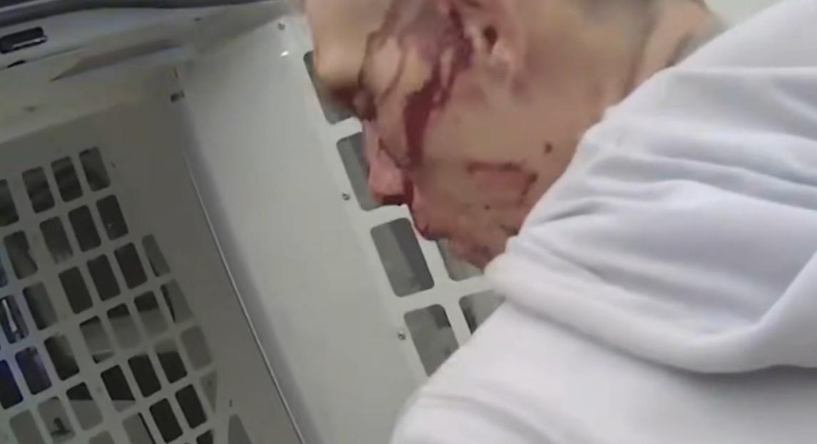 A person with a bloodied face wearing a white hoodie inside a vehicle.