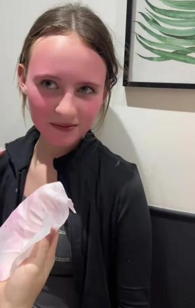 A girl with a pink-dyed face from using a cheap face mask.