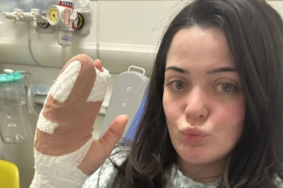 I Tried Too Hard to Impress My New Colleagues—and Ended Up Losing a Body Part!