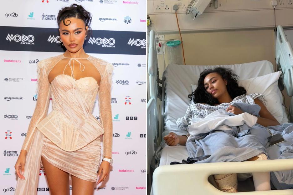 Love Island's Ella Thomas Heads to Hospital for Emergency Surgery Following 'Freak Accident,' Missing Met Gala