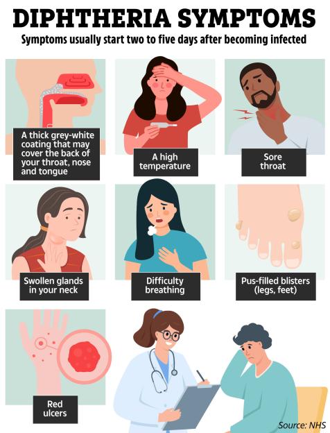 Illustration of diphtheria symptoms.