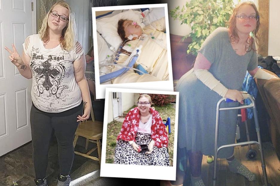 'I Survived a House Fire While Saving His Sister—But He Ghosted Me After My Injuries'