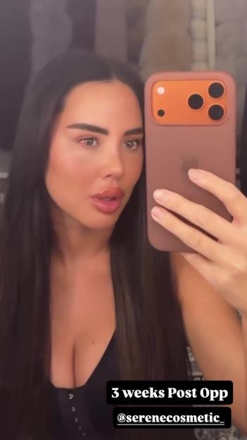 Towie Star Yaz Oukhellou Reveals Stunning Facelift Results Just Three Weeks Post-Surgery!