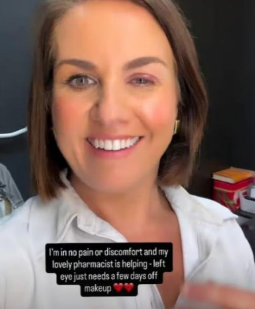Nina Warhurst smiles, revealing a red and swollen left eyelid with the text "I'm in no pain or discomfort and my lovely pharmacist is helping - left eye just needs a few days off makeup."