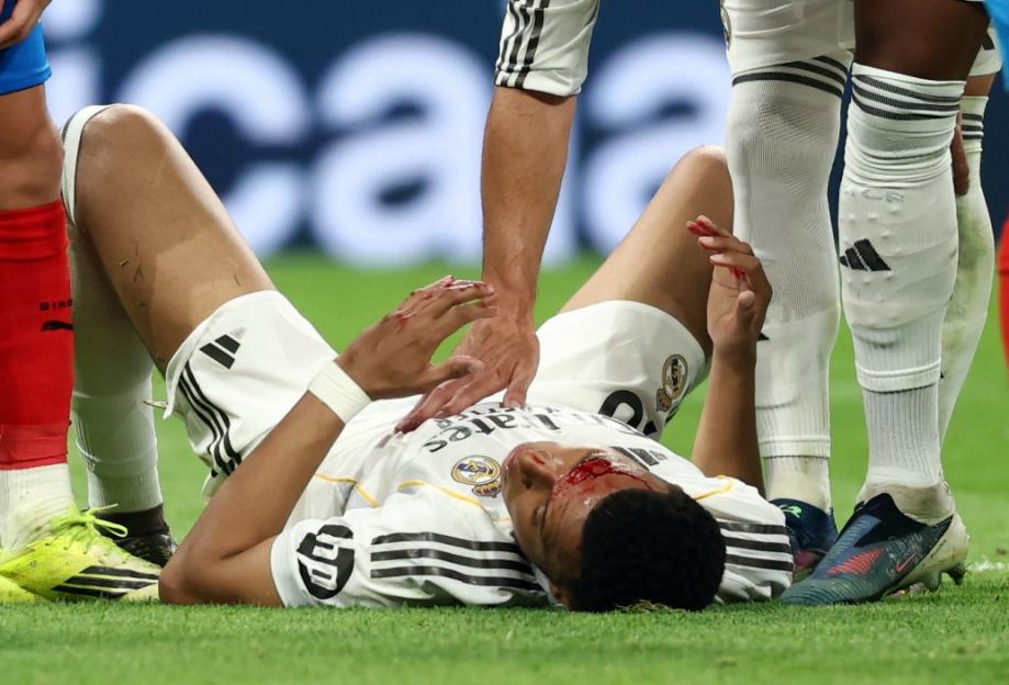 Kylian Mbappé Left Bloodied After Clash with Opponent in Real Madrid Match