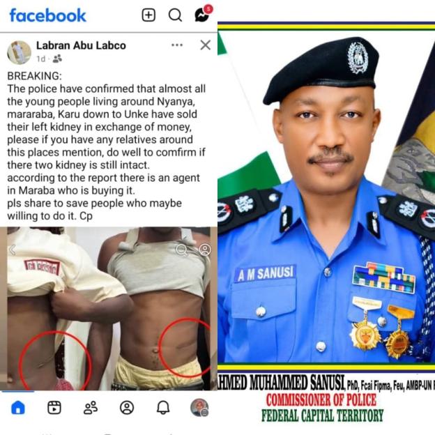 FCT Police Debunk Claims of Youths Selling Kidneys in Mararaba, Nyanya, and Karu