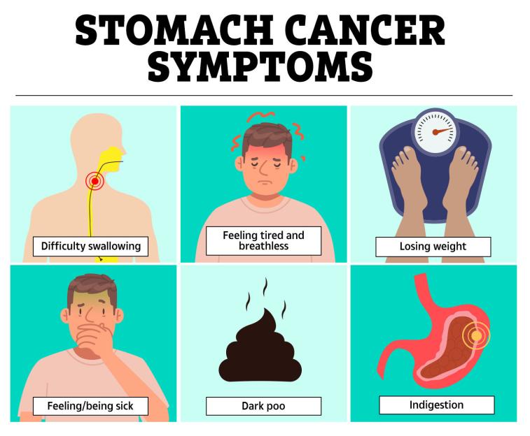 Illustration of stomach cancer symptoms including difficulty swallowing, feeling tired and breathless, losing weight, feeling/being sick, dark poo, and indigestion.