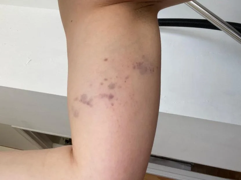 'Monster boyfriend left me traumatised, covered in bite marks and £12k in debt'
