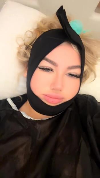 Woman lying down wearing a black compression bandage around her face and jaw, with a black gown over her shoulders.