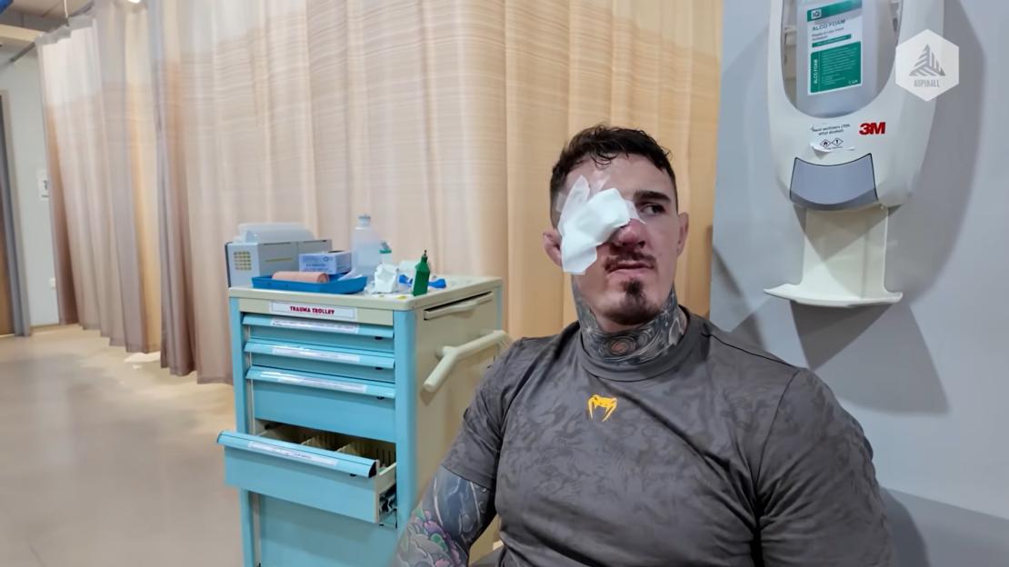 Tom Aspinall with a bandage over his left eye.